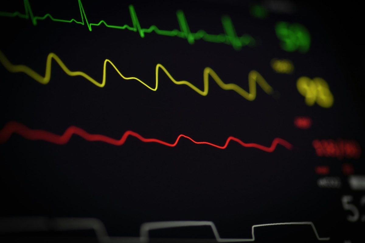 Monitor de signos vitales en primer plano, con tres trazas de colores —verde, amarilla y roja— ondulando de forma continua sin ejes ni números visibles: la misma anatomía de un sparkline, una línea diminuta y sin ejes que comunica una tendencia de un vistazo